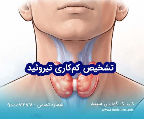راهنمای جامع تشخیص و درمان کم کاری تیروئید