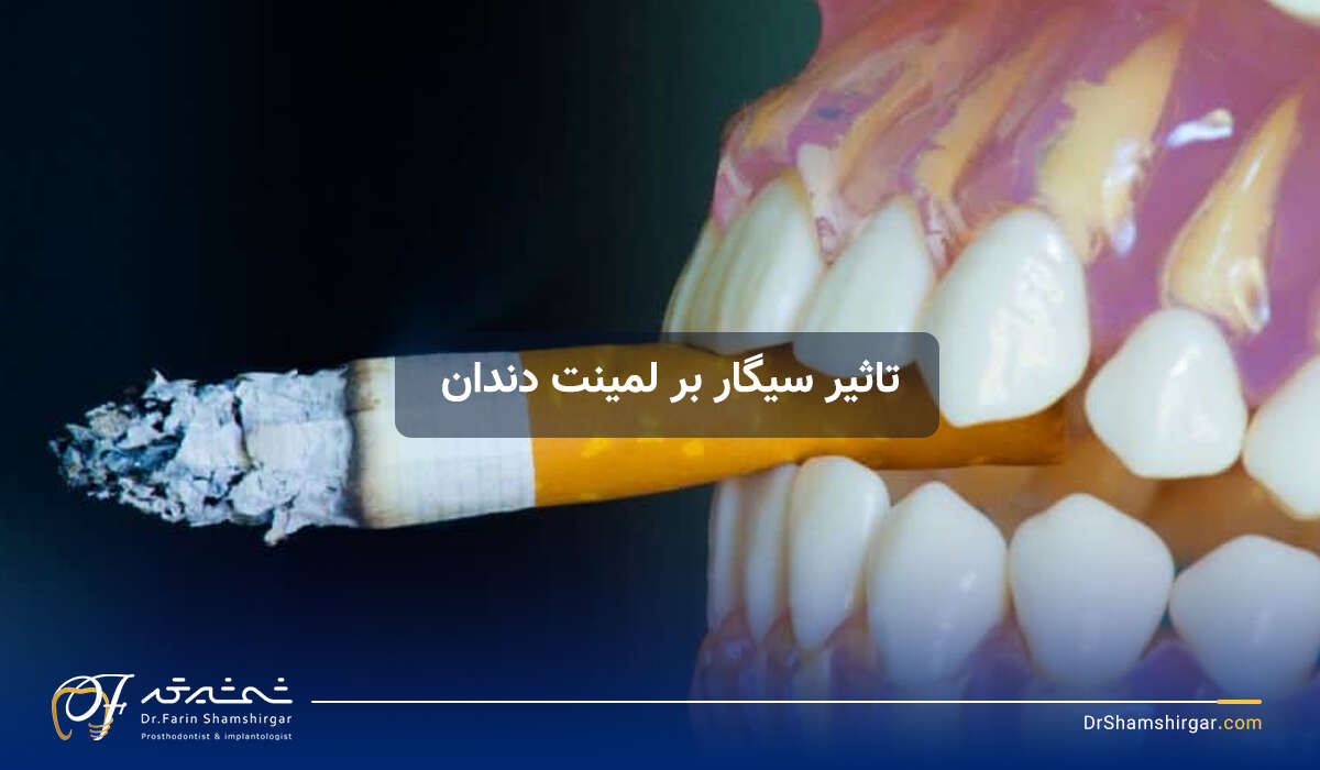 The effect of smoking on dental laminate and the problems it brings