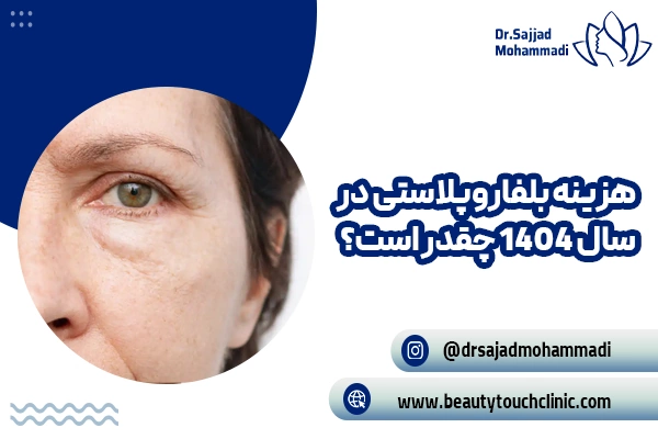 هزینه بلفاروپلاستی در سال 1404 چقدر است؟ | راهنمای کامل قیمت جراحی پلک