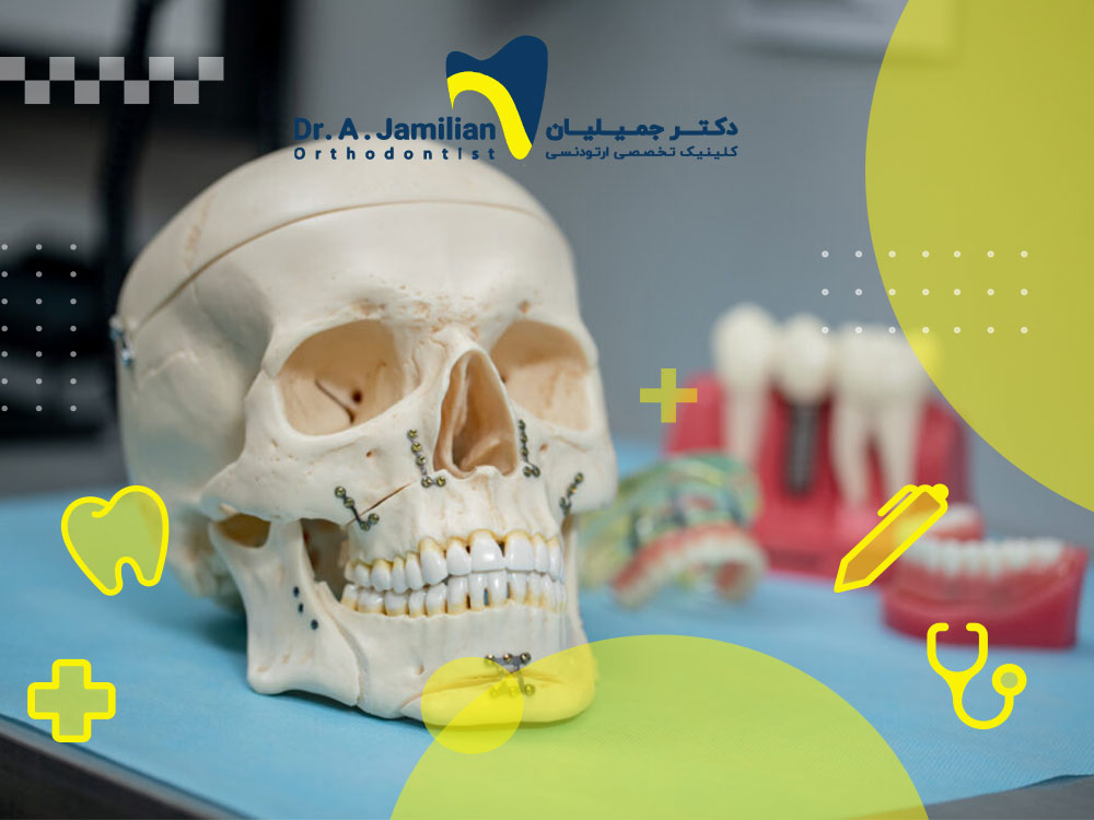 وقت دمج الفك بعد الجراحة: كم من الوقت يستغرق؟ - دكتور جميليان