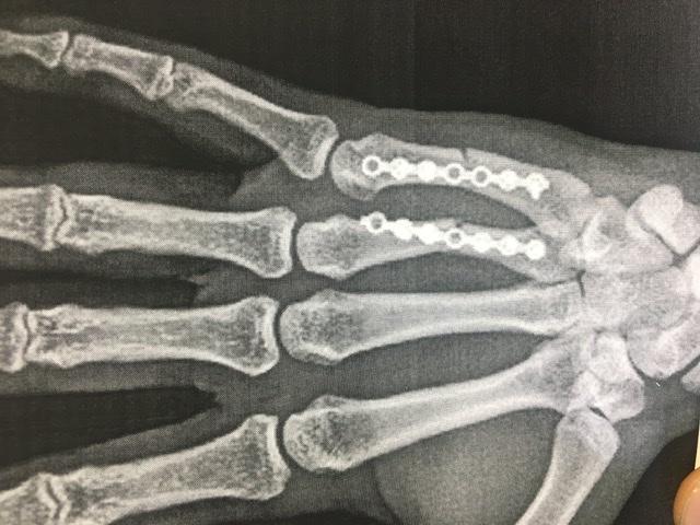 أفضل طبيب متخصص في اليد والكوع في طهران الدكتور أمين كمراني راد