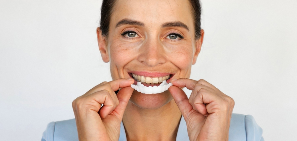 What is removable tooth laminate or Snap-on Smile?