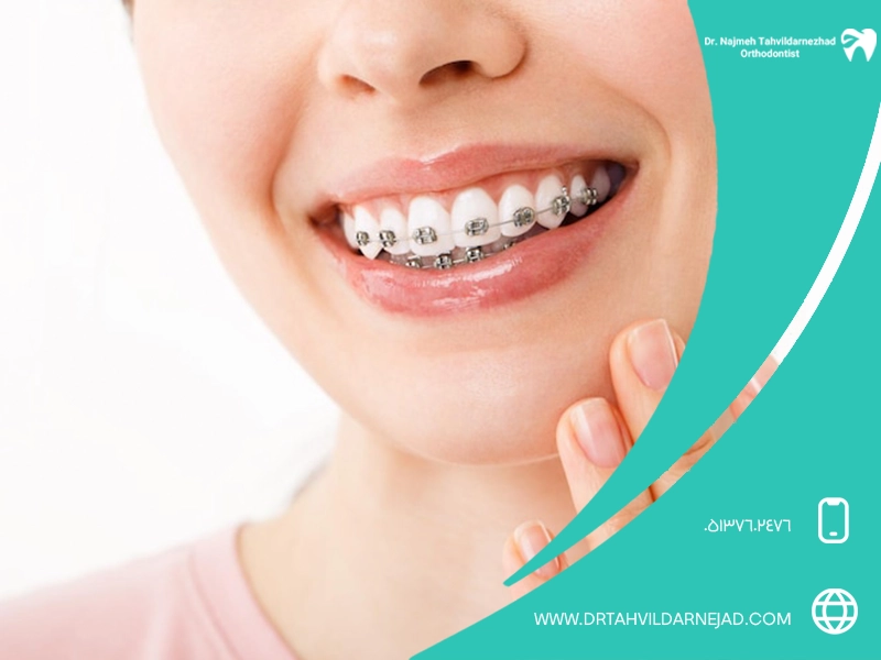 Important points about orthodontics during pregnancy or breastfeeding Dr. Najmeh Tadredaranjad