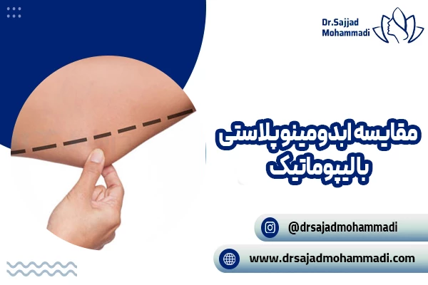 مقایسه ابدومینوپلاستی با لیپوماتیک; ابدومینوپلاستی بهتر است یا لیپوماتیک؟