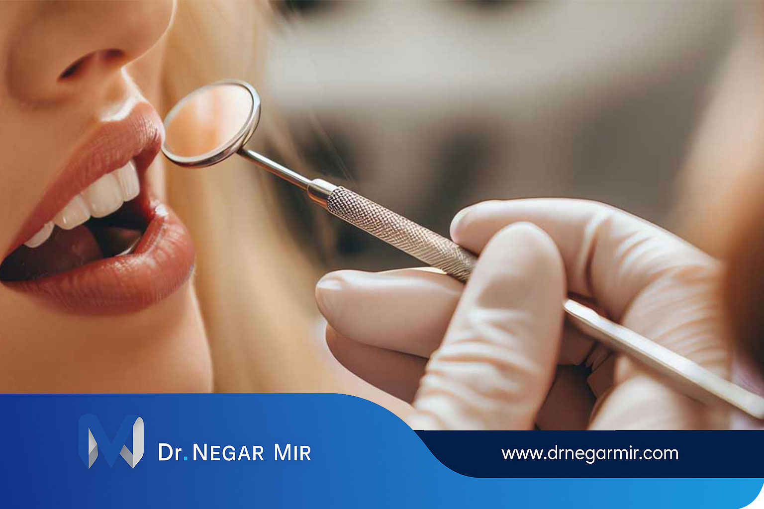 افضل دكتور فينير كمبوزيت و كمبوزيت للاسنان بتكلفة 1404