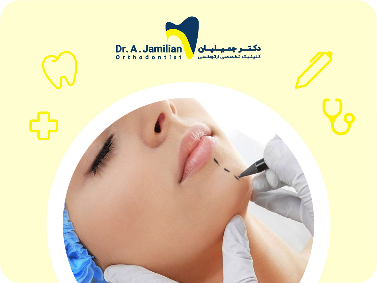 كل شيء عن جراحة الذقن والفكين (رأب الذقن) - دكتور جميليان