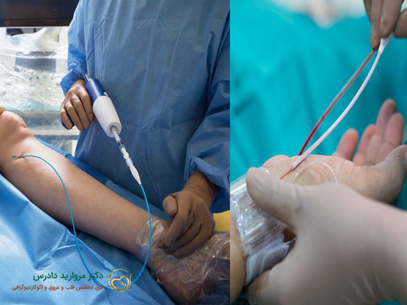 هل تصوير الأوعية أفضل باليد أم بالقدم؟ - د. مارفاريد دادرس