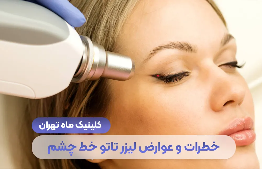 المخاطر والآثار الجانبية لوشم الكحل بالليزر + فيلم الكحل بالليزر - Mah Clinic طهران