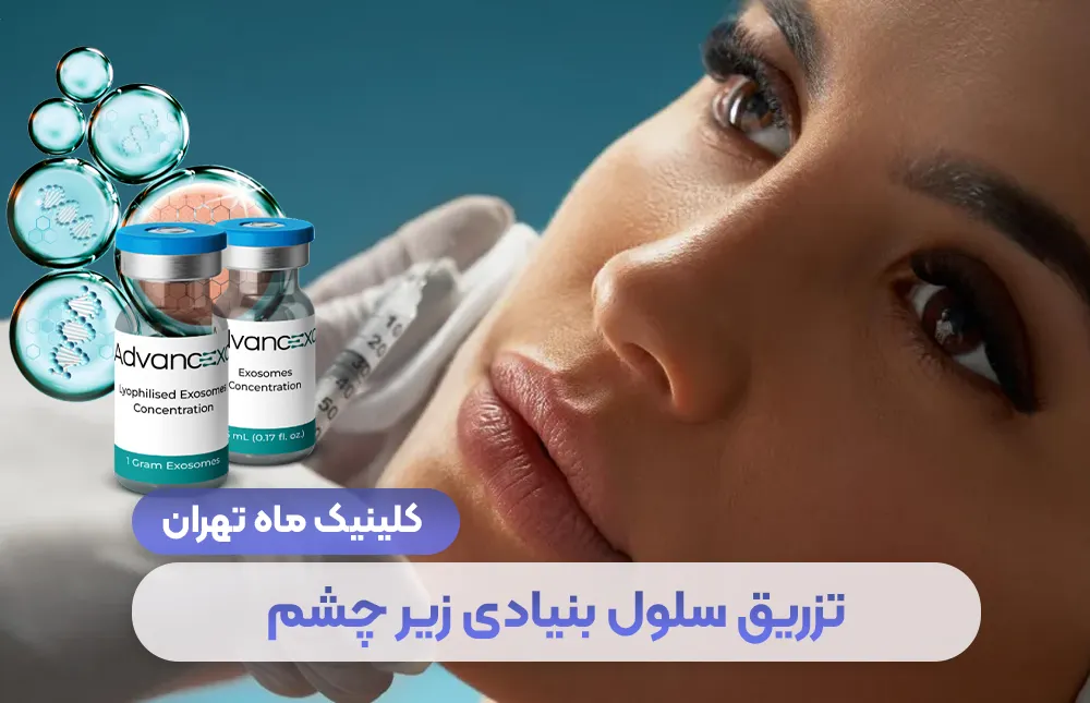 تجديد عميق لمنطقة تحت العين بحقن الخلايا الجذعية + التكلفة - عيادة ماه، طهران