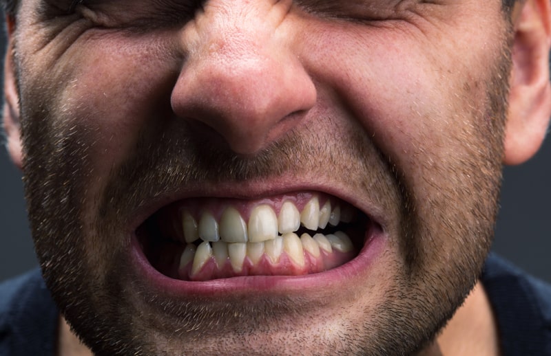 Does grinding teeth prevent implants? + Challenges and solutions