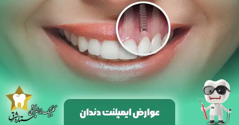 راهنمای کامل عوارض ایمپلنت دندان