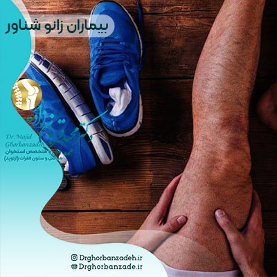 آسیب های زانو در بیماران زانو شناور - صفر تا صد توضیحات مهم!