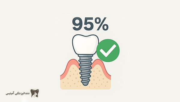 What is the success rate of dental implants in different people? | Amytis
