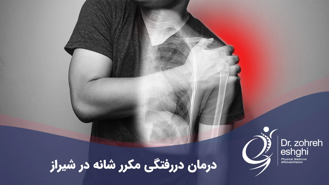 درمان دررفتگی مکرر شانه در شیراز