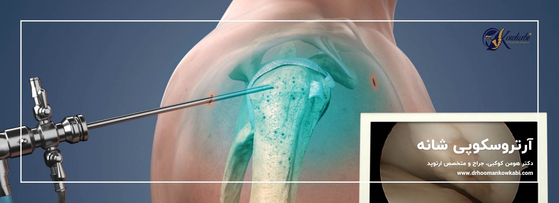 آرتروسکوپی شانه در تهران | بهترین جراح ارتوپد دکتر هومان کوکبی