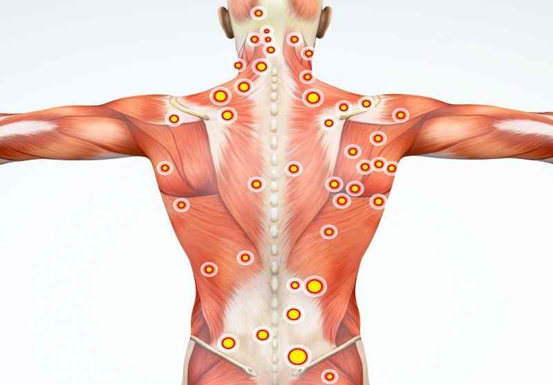 Physiotherapy of Iranians