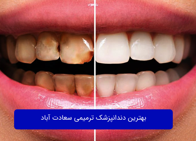 أفضل طبيب تجميل وترميم أسنان في مدينة الغرب