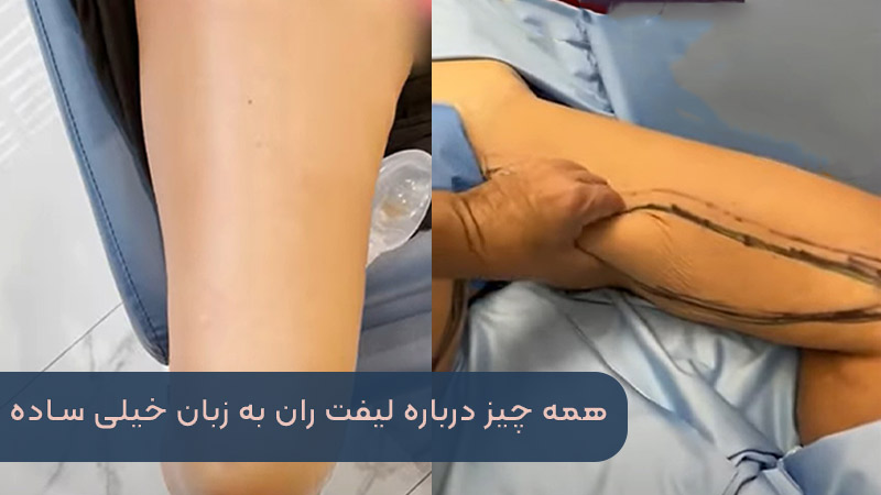 كل شيء عن الرفع يتم بلغة بسيطة جدًا