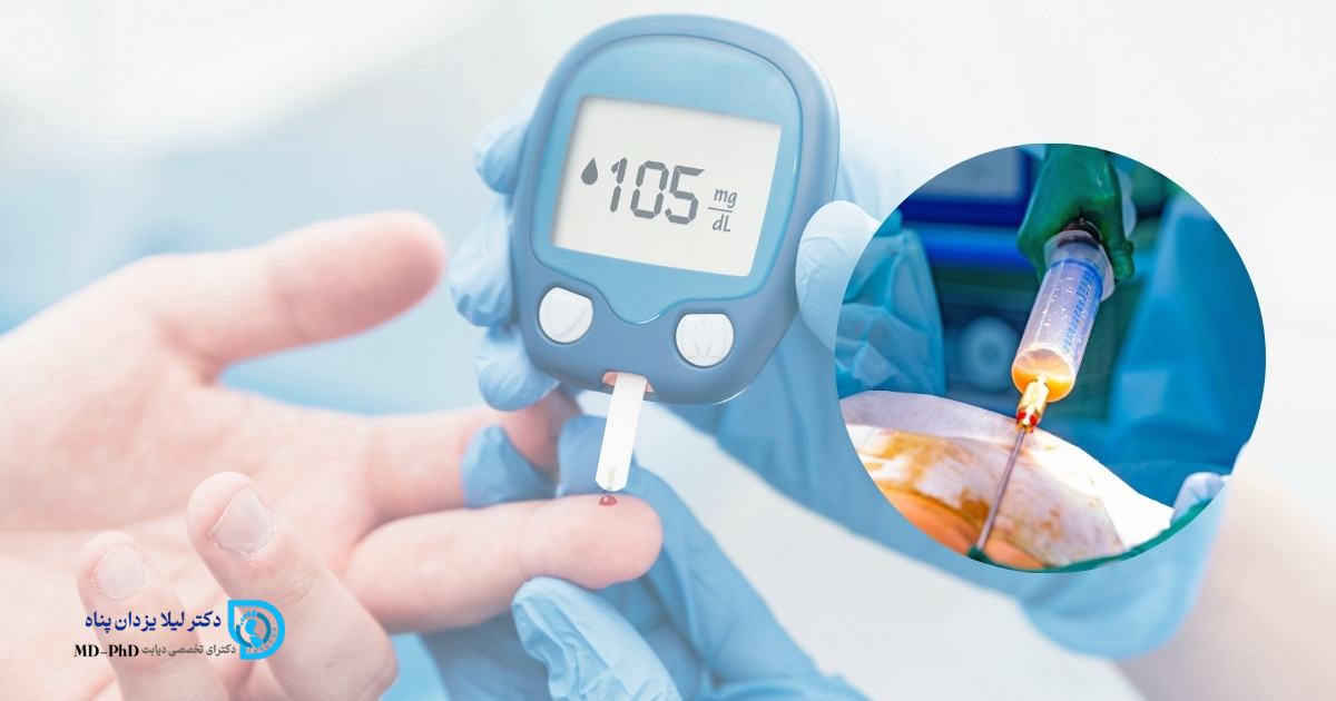 آیا لیپوماتیک برای بیماران دیابتی امکان پذیر است؟