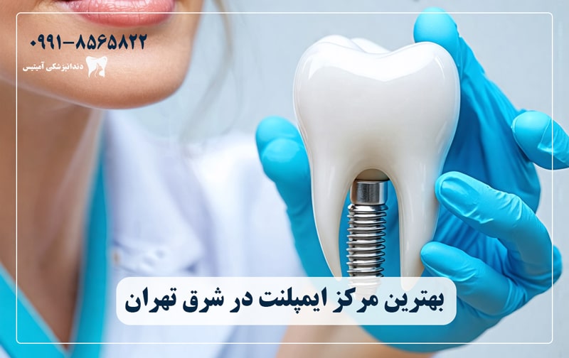 Introducing the 10 best clinics and implant centers in East Tehran Amytis