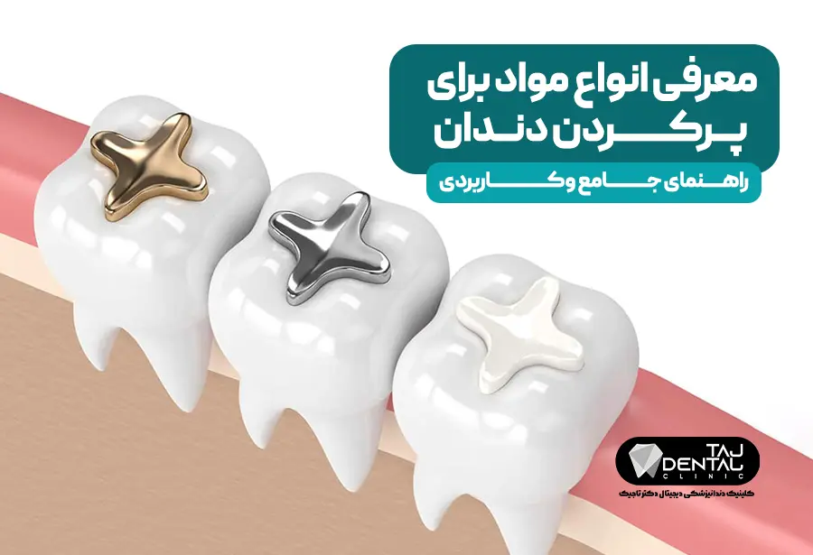 Introduction of various materials for tooth filling: a comprehensive and scientific guide