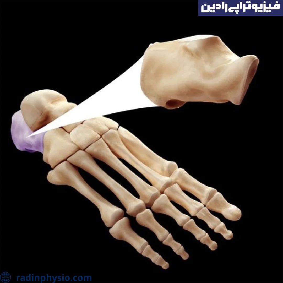 Heel fracture physiotherapy - Radin Physiotherapy Clinic
