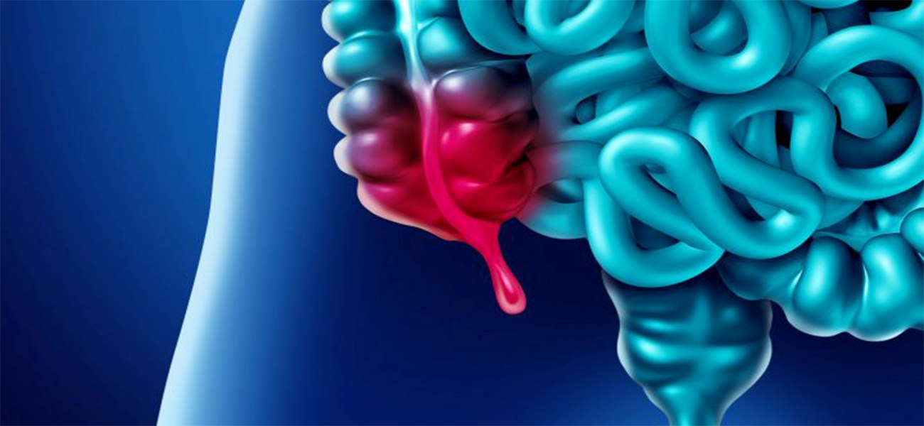 أفضل جراح الزائدة الدودية في ظفار