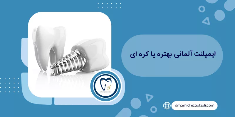 هل الغرسة الكورية أم الألمانية أفضل؟ | دكتور حميدرضا أفضلي