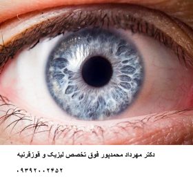 Felisik یا cairs چیست 360 - دکتر مهرداد محمدپور