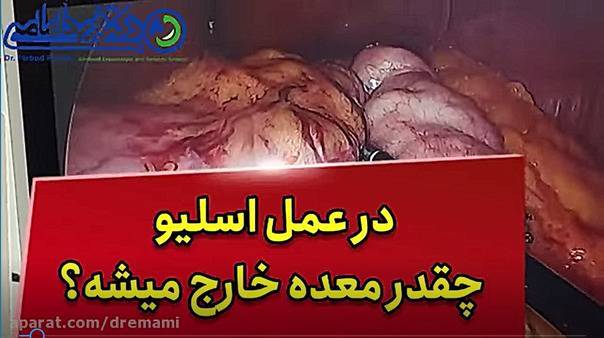 فيديوهات للدكتور فرباد إمامي يجانه