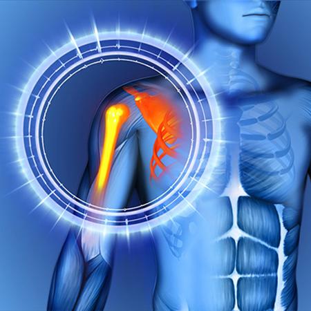 أفضل جراح الكتف والكوع في طهران، أكثر من 8 آلاف عملية ناجحة | دكتور كمراني