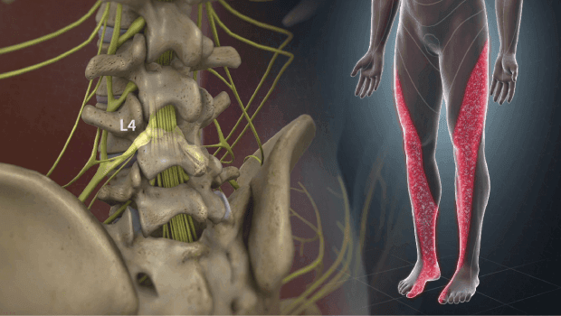 درد عصبی کجای بدن می رود؟