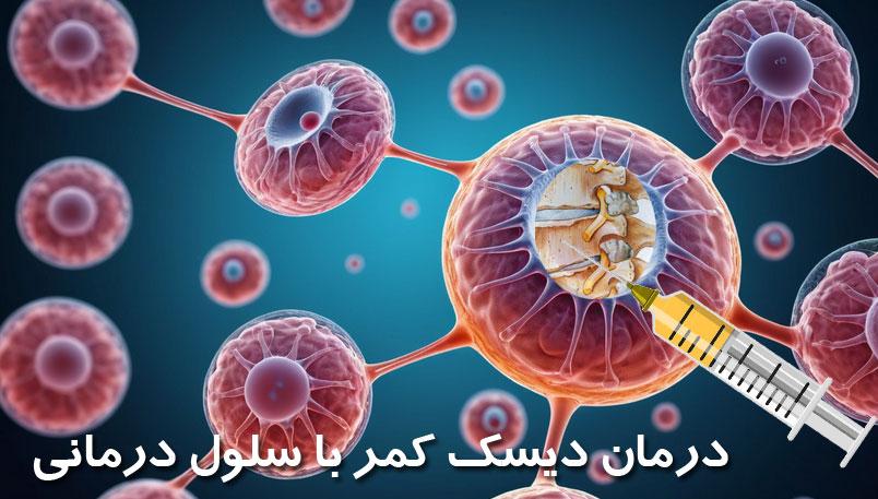 Lumbar disc treatment with lumbar disc stem cells (advantages of cell therapy)