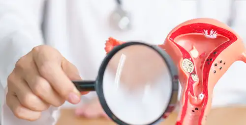 تاثیر میوم بر باروری و بارداری