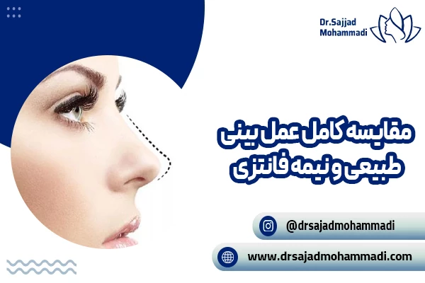 مقایسه کامل رینوپلاستی طبیعی و نیمه فانتزی; کدام مدل برای شما مناسب تر است؟