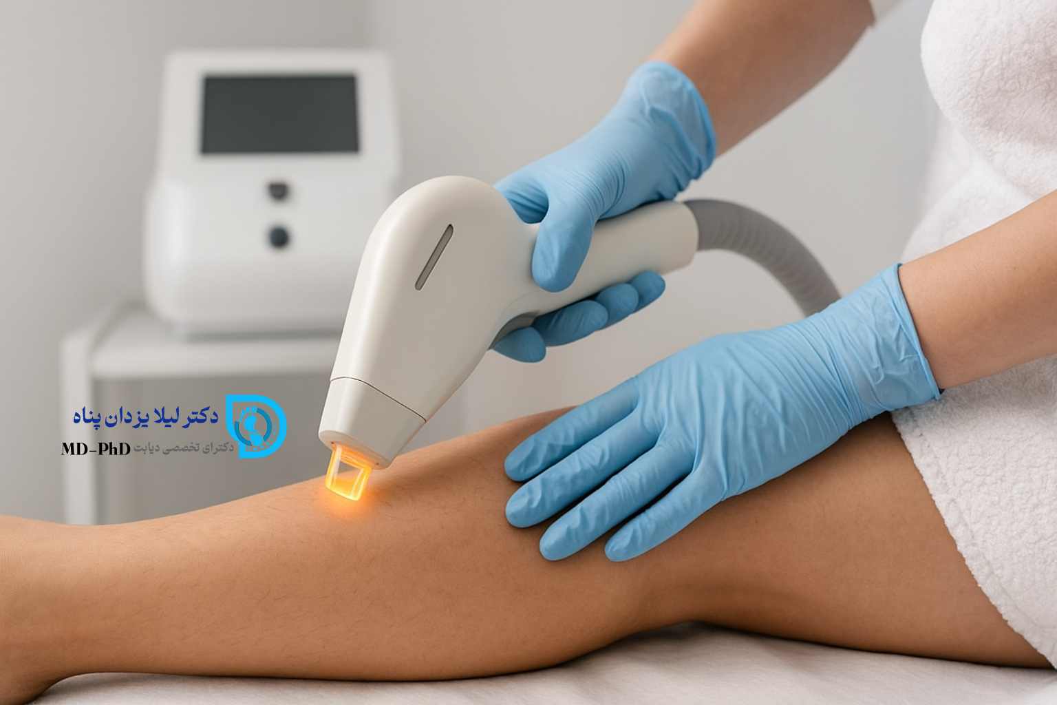 دیابت و لیزر موهای زائد