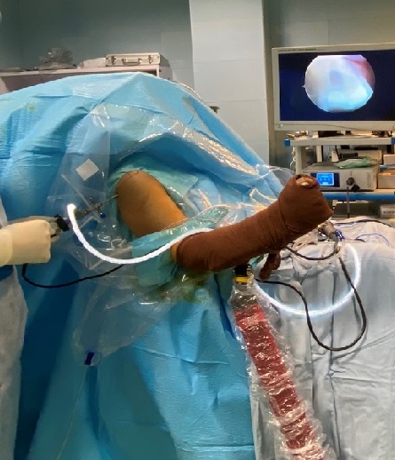 Instructions after rotator cuff tear repair surgery