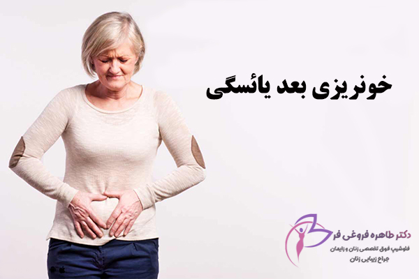 علت خونریزی بعد از یائسگی چیست؟ - دکتر طاهره فروغی فر