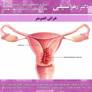Endometrial scratch Good gynecologist Gynecologist The best gynecologist