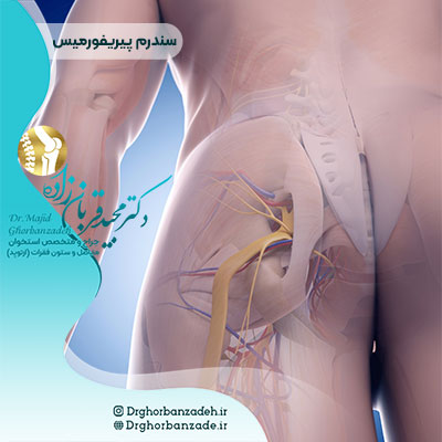 سندرم پیریفورمیس چیست؟ | دکتر مجید قربان زاده