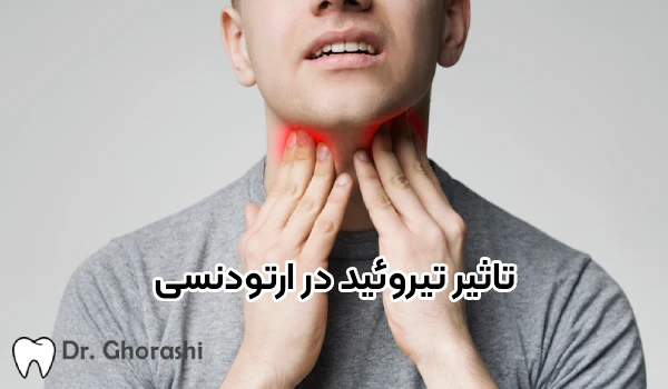 تاثیر تیروئید در ارتودنسی چیست؟