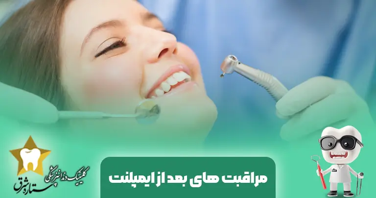 مراقبت های بعد از ایمپلنت دندان