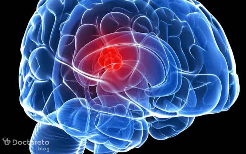 ما هو الجهاز العصبي وما هي مكوناته؟