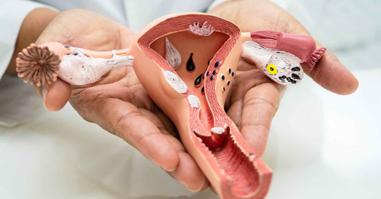 ماذا نأكل لكسل المبايض [التغذية الأنسب] | دكتور شيفا مدني
