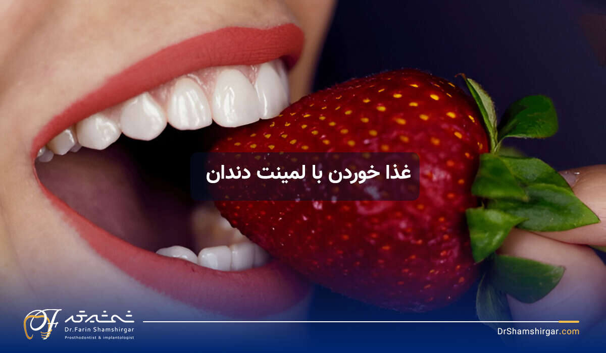 0 to 100 important tips and care for eating after dental laminate