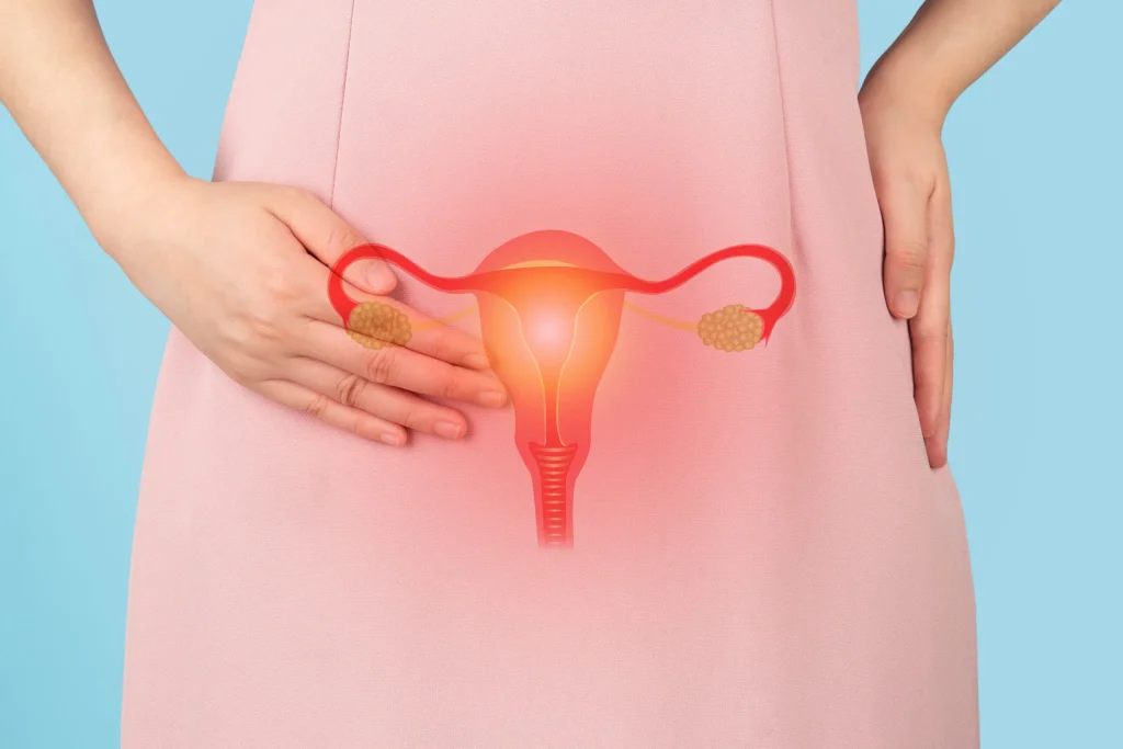 Symptoms and how to treat ovarian cysts in girls ❤️