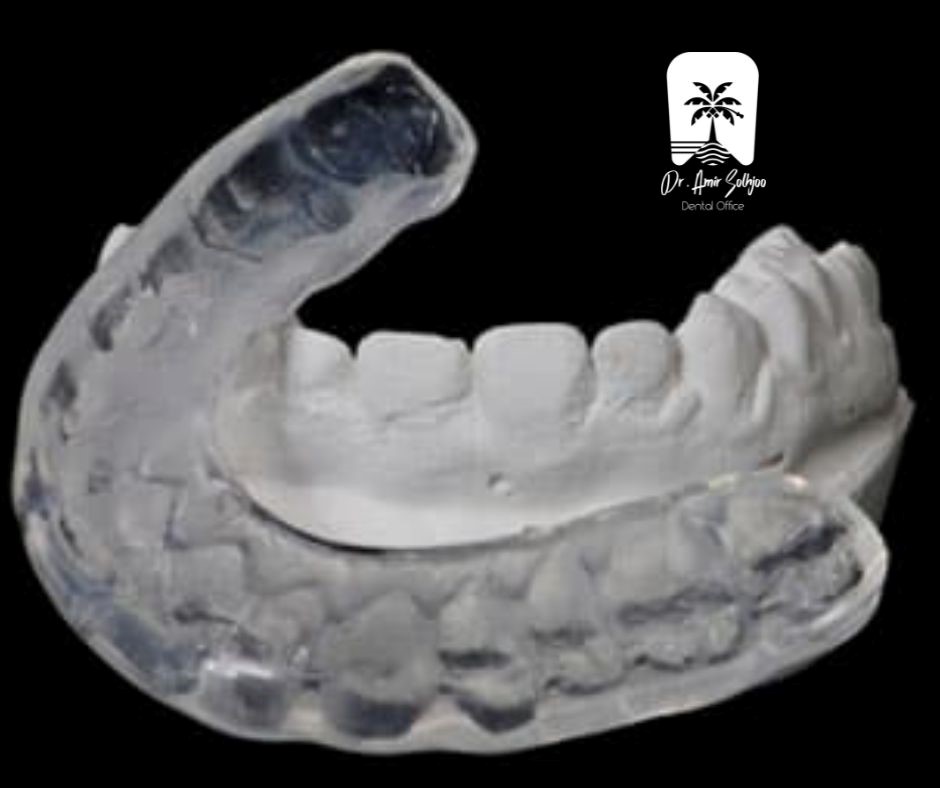 زراعة الأسنان لدى الأشخاص الذين يعانون من طحن الأسنان: التحديات والحلول المتخصصة