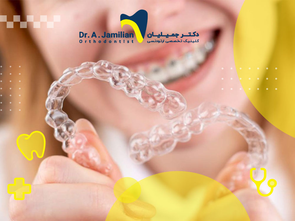 How long is the treatment with invisible orthodontics? - Dr. Jamilian