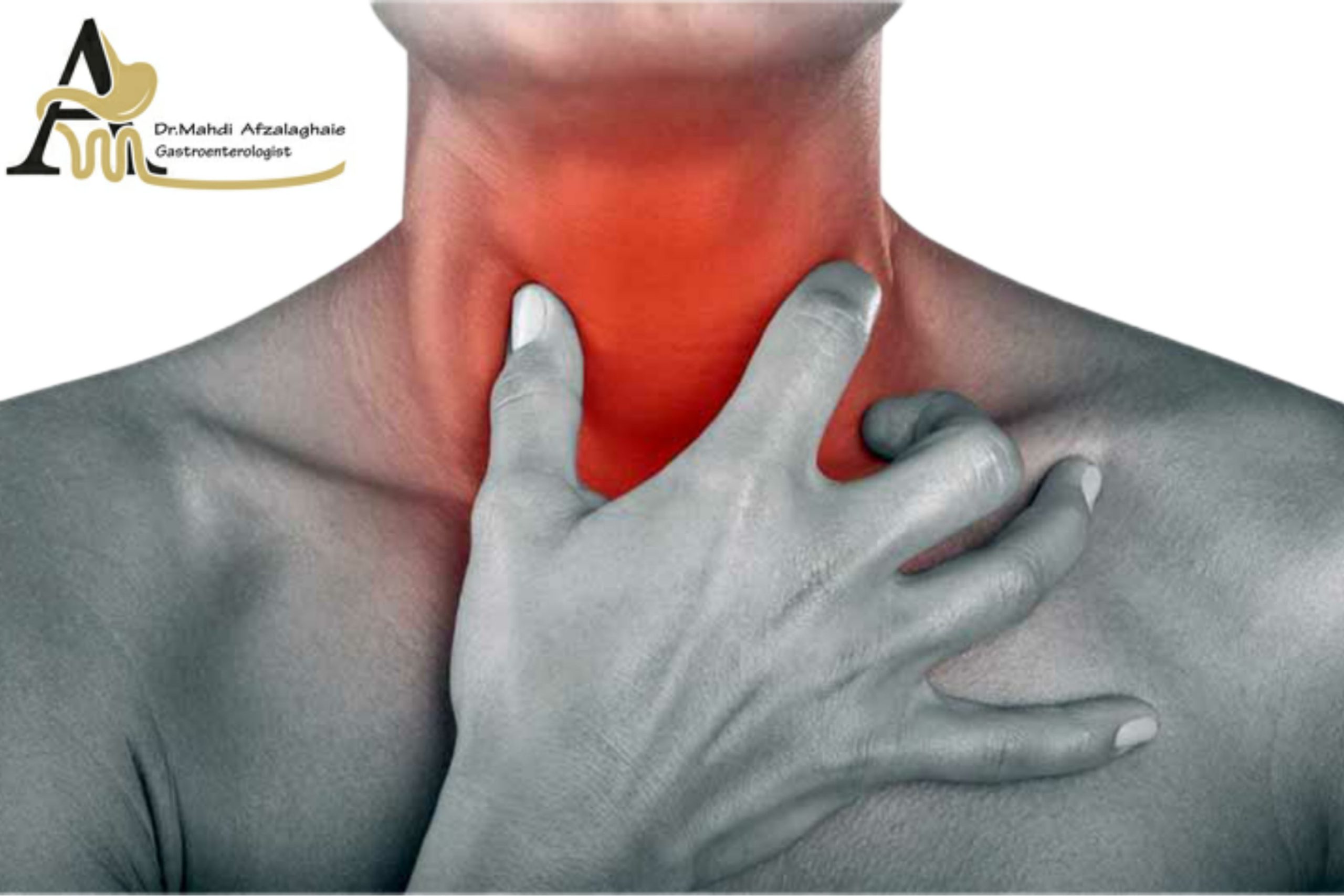 Painful swallowing - Gastroenterologist in Mashhad Dr. Mehdi Afzal Aghaei