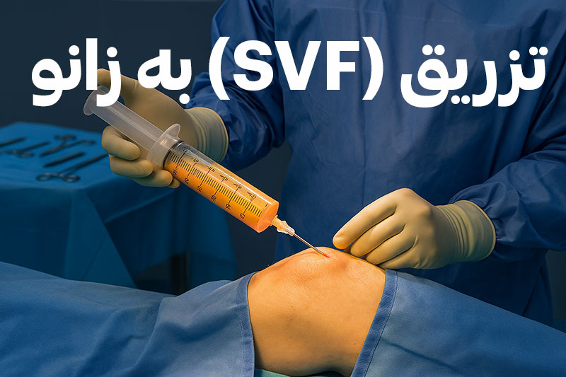 معجزة حقن الدهون SVF في الركبة وداعا لآلام والتهابات المفاصل + التكلفة